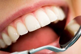 An introduction to teeth whitening