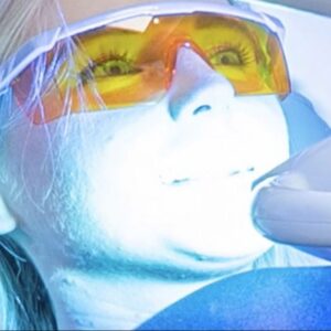 Top Teeth Whitening Treatment Dublin.