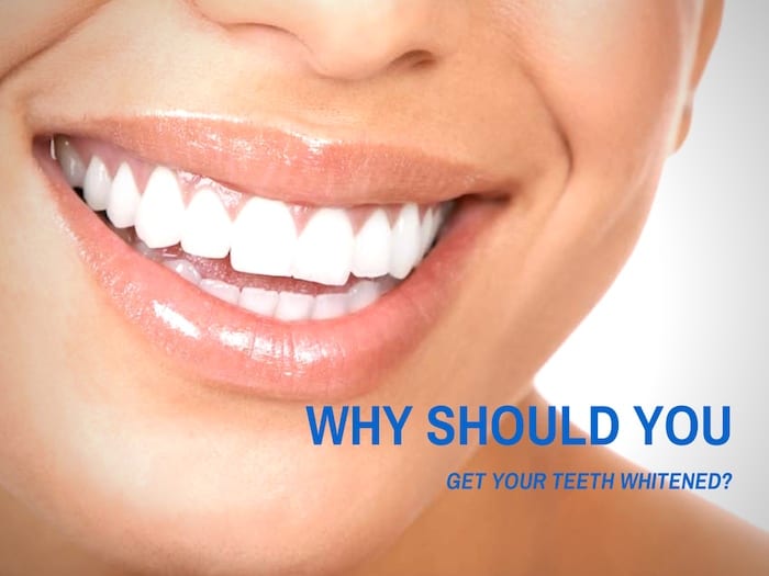 Is teeth whitening for you?