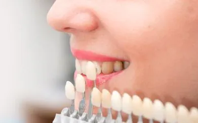 teeth whitening dublin white teeth